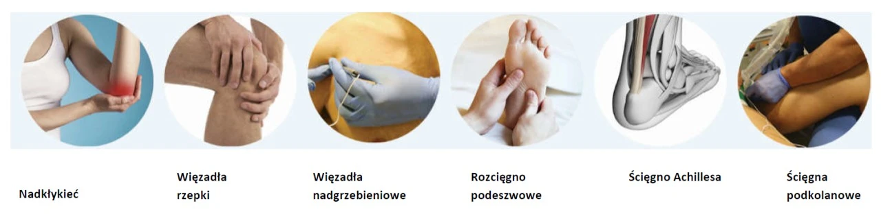 epte-schorzenia